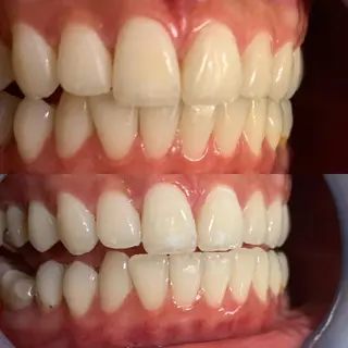 LOVE ホワイトニング新宿店のその他イメージ