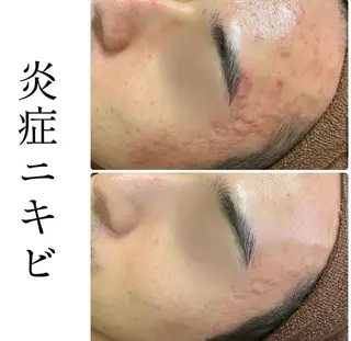 ハーブピーリング専門 BIOPLUS+川崎のエステ・リラクイメージ
