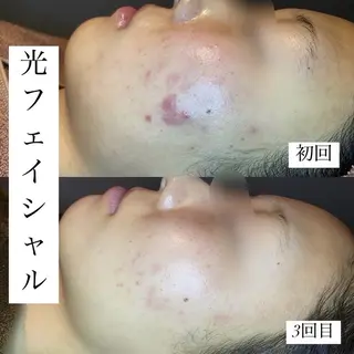 emiluca西目/ 毛穴洗浄/細胞美容のエステ・リラクイメージ