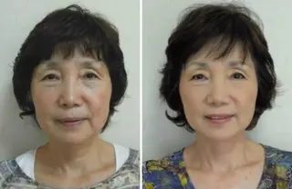 美容整体/小顔エステ glanz横浜馬車道のその他イメージ