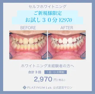 ホワイトニングビューティー西宮店所属・ホワイトニングビュー ティー西宮店のその他イメージ