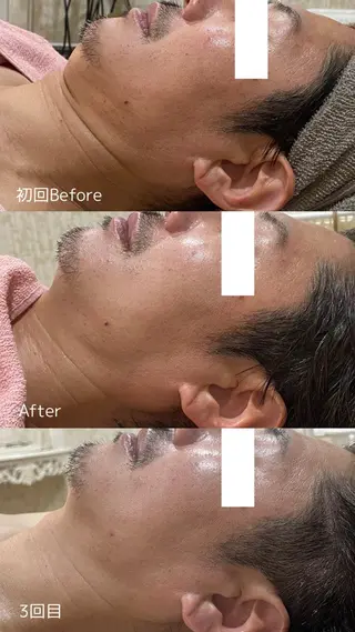 フェイシャル/脱毛 ジョアアンジェ竹田のエステ・リラクイメージ