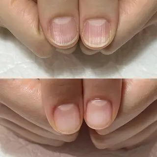 ネイル 自爪育成・巻き爪 補正講師　津蔵のネイルデザイン