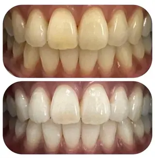 ルミナホワイト 店長 もえかのその他イメージ