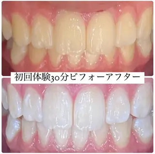 ホワイトニングルーム 横浜店のその他イメージ