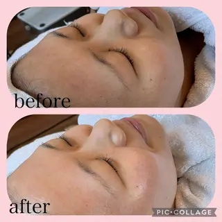 NATURA所属・シェービングサロン NATURAのエステ・リラクイメージ