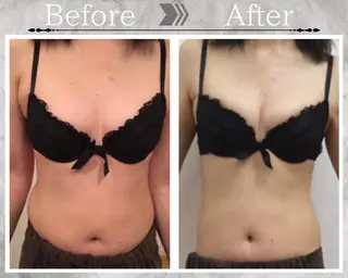 Feliz(ユーカリレンタルサロン内)所属・【バストケアサロン】 Feliz フェリスのエステ・リラクイメージ