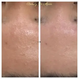 ビューティー ミロワールのエステ・リラクイメージ