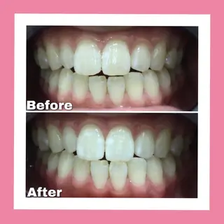 Briller 浜松のエステ・リラクイメージ