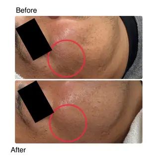 ROR所属・ROR Nanaのネイルデザイン