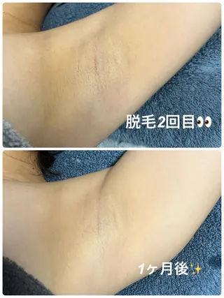 blue.💙【 脱毛&フェイシャル】のエステ・リラクイメージ