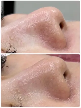 お手入れ眉/小顔 /プライベートサロンのエステ・リラクイメージ