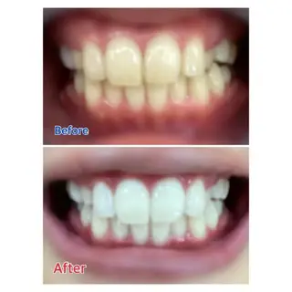 M渋谷 ホワイトニングのエステ・リラクイメージ