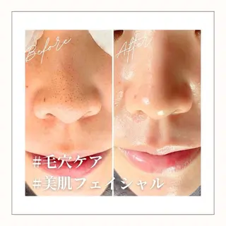 LIKO ボディ＆フェイシャルのエステ・リラクイメージ