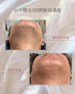 DISINI  SPA所属・DISINISPA 脱毛/フェイシャルのエステ・リラクイメージ