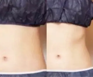 メンズ beauty salonnのエステ・リラクイメージ