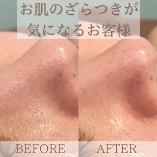 メンズ キッズ ネイル マツエク・マツパ 小顔・美肌 ルミエールのエステ・リラクイメージ