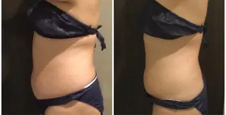 Re, Luxのエステ・リラクイメージ