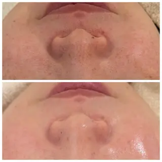 Raviy(A.) 【痩身・韓国肌管理】のエステ・リラクイメージ