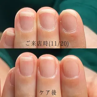 ネイル Aim* 深爪自爪育成専門店のネイルデザイン