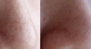 朝重い人専用 肩甲骨調整のエステ・リラクイメージ