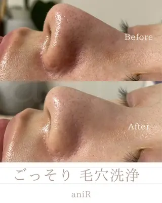 北浜/毛穴洗浄ツヤ肌 サロンaniRのエステ・リラクイメージ