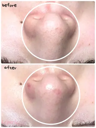 Le'perle。所属・Le'perle。 Kyokaのエステ・リラクイメージ