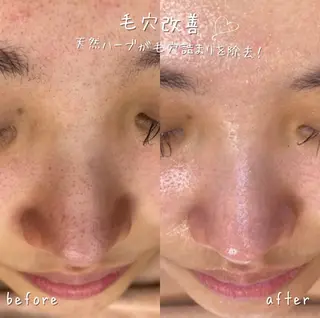 NA skin たまプラーザ　川島のエステ・リラクイメージ