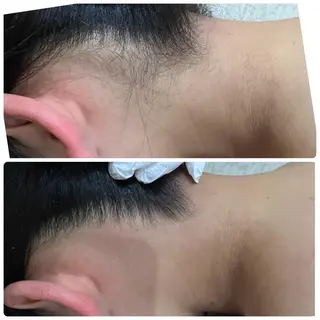 エステ矢野 ジョアアンジェ心斎橋のエステ・リラクイメージ