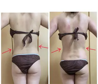 痩身/脱毛/ネイル HARUKAのエステ・リラクイメージ