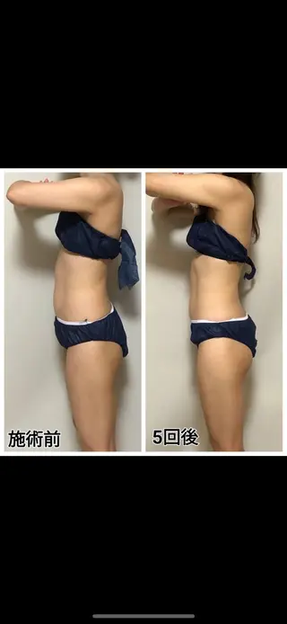 salon lady_goのマツエク・マツパデザイン