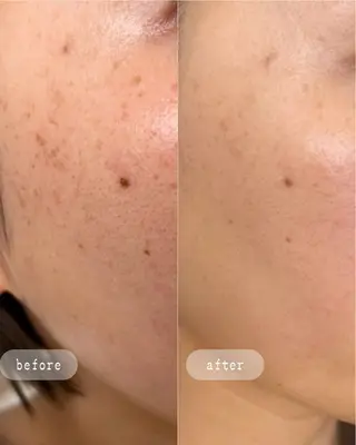 LaVibe ann.のエステ・リラクイメージ