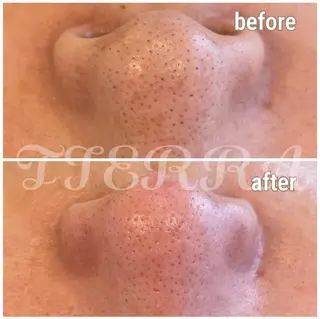 TIERRA(ティエラ)所属・TIERRA ♡のエステ・リラクイメージ