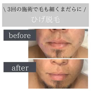 脱毛サロン Lokahiのエステ・リラクイメージ