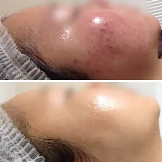 都度払い肌質改善 &脱毛Blancheのエステ・リラクイメージ