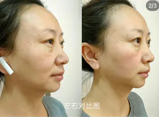 aliaハーブ水光店 エステティシャン募集のエステ・リラクイメージ