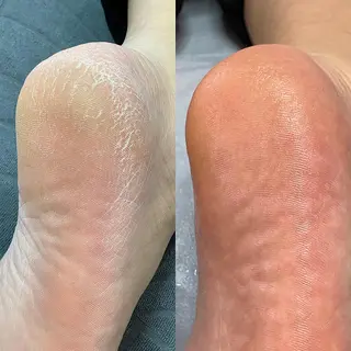 ネイル Takasaki Keikoのネイルデザイン