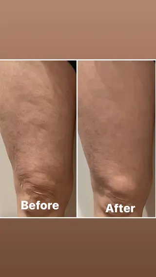 nina《快眠ドライヘッドスパ＆ボディーリンパケア》所属・nina 野沢あゆみのエステ・リラクイメージ