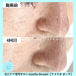 毛穴ケア専門サロン アメリオボーテのその他イメージ