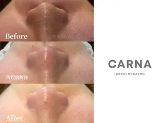 CARNA所属・【肌質改善専門店】 CARNAのエステ・リラクイメージ