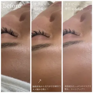 Lereve 三宮店所属・Lereve .三宮店のエステ・リラクイメージ