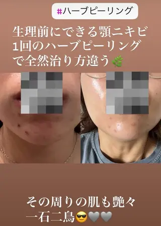 Esthetic ReTweetのエステ・リラクイメージ