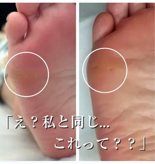 巻き爪フットケアサロンKotori所属・フットケアサロン Kotoriのその他イメージ