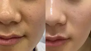 ヘアアレンジ aliaハイフ&水光ジェットサロン所属・aliaハーブ水光店 エステティシャン募集のエステ・リラクイメージ