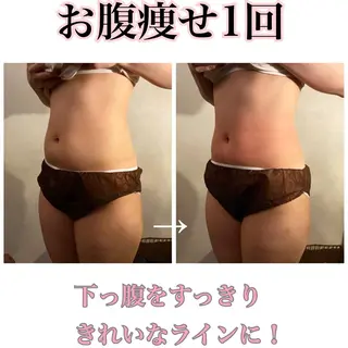 美容鍼灸サロン YOSHINOのエステ・リラクイメージ