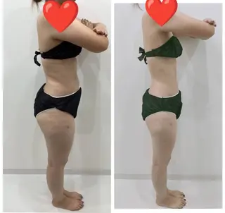 痩身/肌改善/脱毛 /リラク/MoaNaのエステ・リラクイメージ