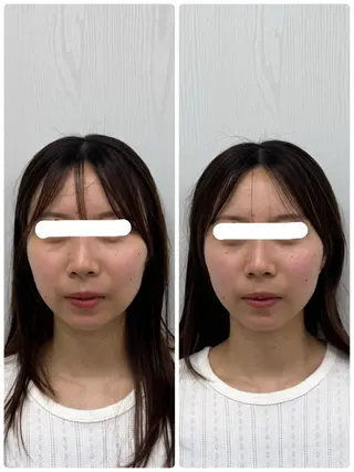 美容鍼×小顔矯正 ×美容整体　浜川泰仁のエステ・リラクイメージ