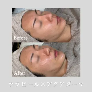 看護師が施術する ナスサロ/Emi🪽のエステ・リラクイメージ