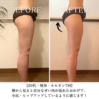 【三軒茶屋/下馬】 本格痩身・よもぎ蒸しのその他イメージ