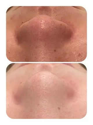 total beauty TLIENGLE［ﾄﾘｱﾝｸﾞﾙ］所属・tliengle ［ﾄﾘｱﾝｸﾞﾙ］のネイルデザイン